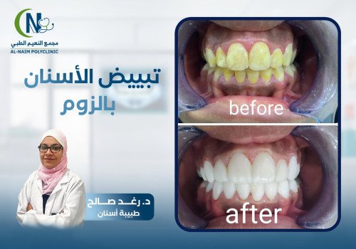 حالة قبل وبعد