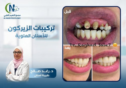 حالة قبل وبعد