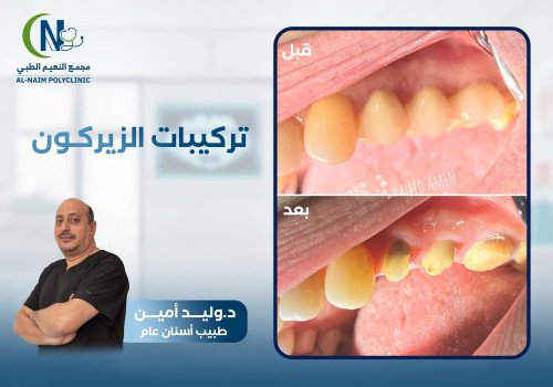 حالة قبل وبعد