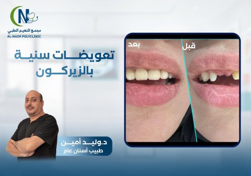 حالة قبل وبعد