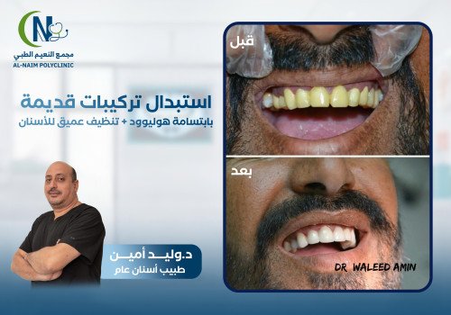 حالة قبل وبعد