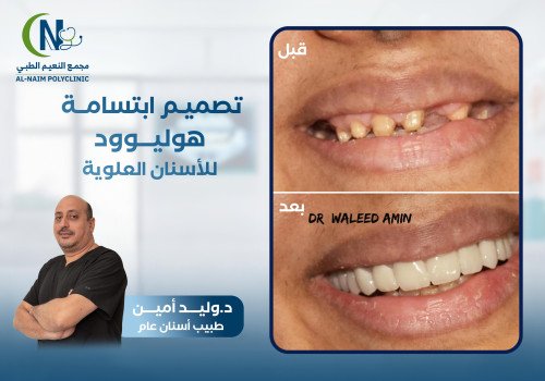 حالة قبل وبعد