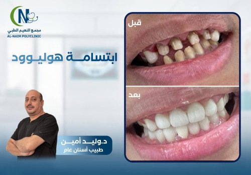 حالة قبل وبعد