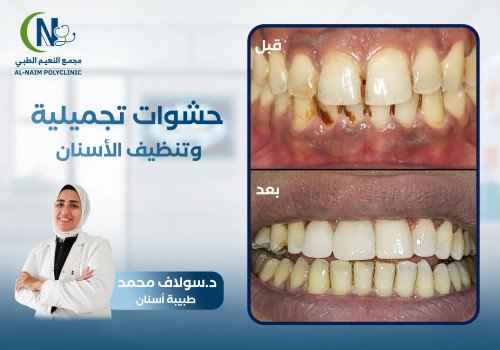 حالة قبل وبعد