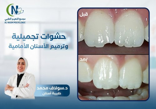 حالة قبل وبعد