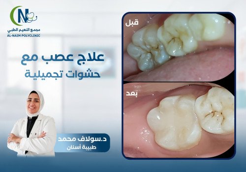 حالة قبل وبعد