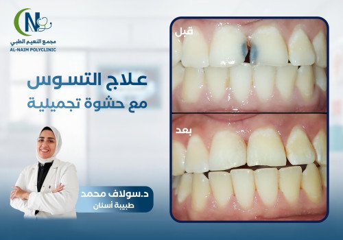 حالة قبل وبعد