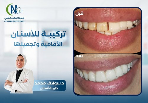 حالة قبل وبعد