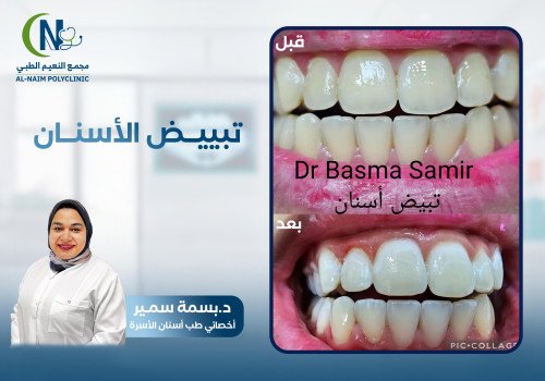 حالة قبل وبعد