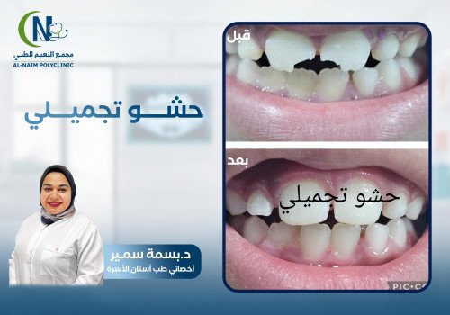 حالة قبل وبعد