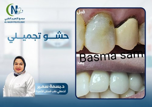 حالة قبل وبعد