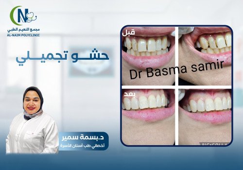 حالة قبل وبعد