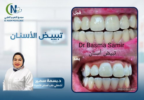 حالة قبل وبعد