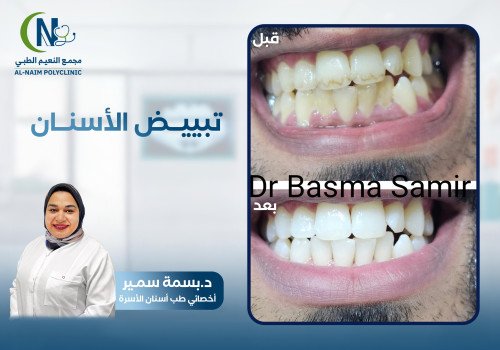 حالة قبل وبعد