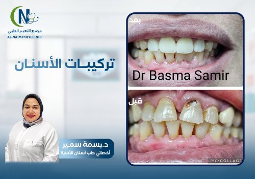 حالة قبل وبعد