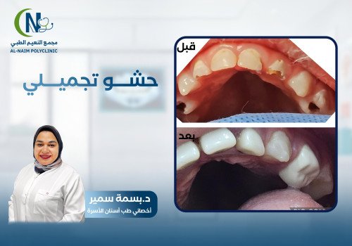 حالة قبل وبعد