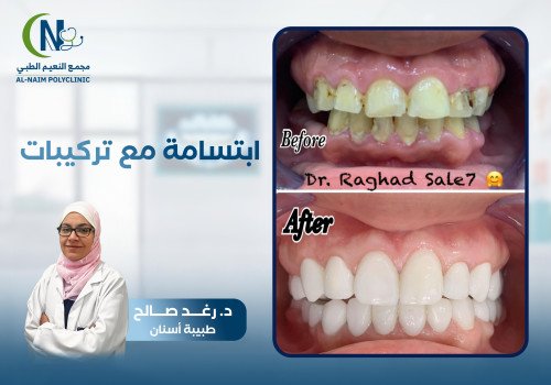 حالة قبل وبعد